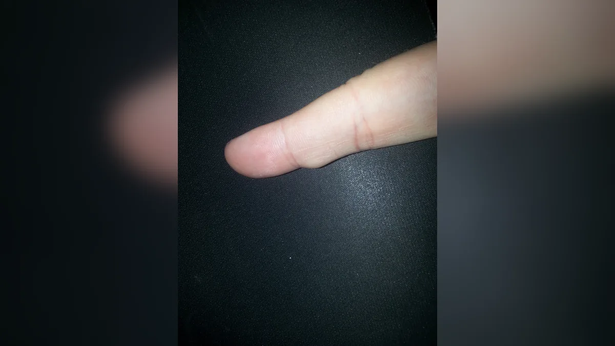 Сонник указательный палец правой руки